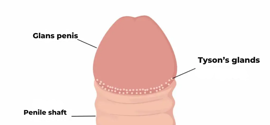 Diagrama de pápulas perladas p-nilianas (PPP) e glândulas de Tyson mostrando pequenas bolinhas brancas na glande do p-nis ao redor da coroa — variação anatômica normal